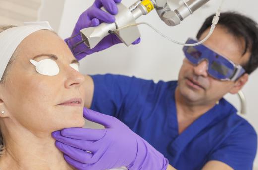 Laser hair removal is more permanent than IPL, but also much more expensive.