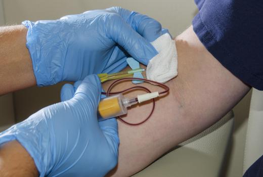 Doctors can ensure a patient is within a normal CRP range through a blood test.