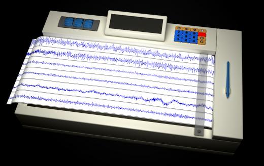 A type of neurofeedback equipment, an electroencephalogram -- or EEG -- machine measures electrical impulse activity in the brain and can help give a diagnosis for conditions such as epilepsy.