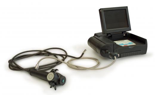 Endoscopy equipment, which is used to diagnose duodenitis.