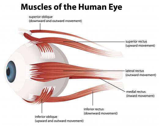 People with Duane syndrome fail to develop a cranial nerve called the abducens nerve, which is in charge of the eye muscles that move the eye laterally.