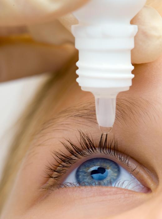 Antihistamine eye drops are applied by squeezing the bottle while positioned directly over one eye.