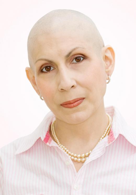 Hair loss may occur as early as the second week after the first cycle of chemotherapy.