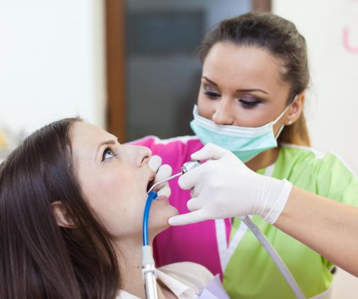 Flouride varnish is applied by a dental hygienist to the back molars.