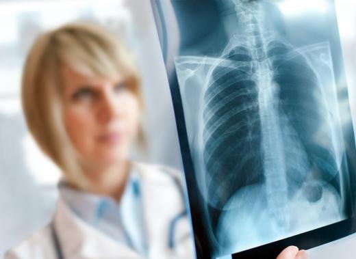 A chest X-ray can be used to diagnose usual interstitial pneumonia in patients.