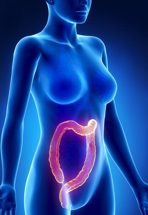 Active colitis is when a person experiences the symptoms of the disease.