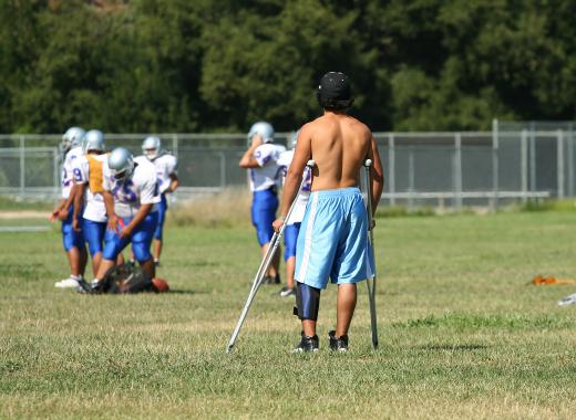 Crutches will be needed for about six weeks following a surgery for a torn meniscus.