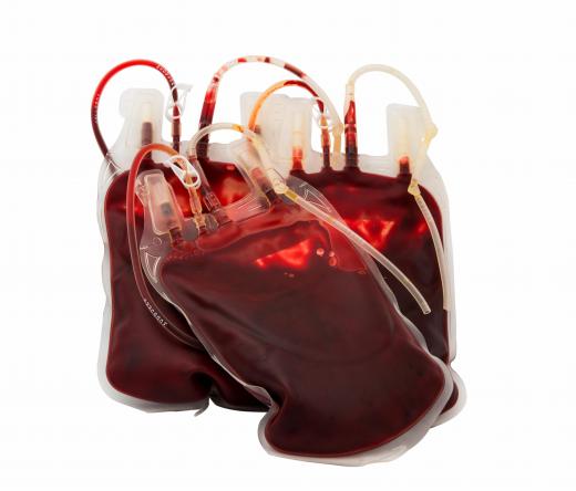 Clinical pathologists may work with blood banks to process donated blood.