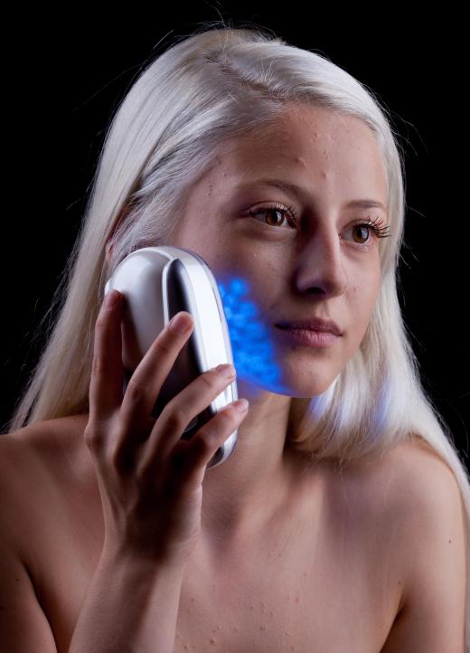 Blue light therapy can help clear up acne.