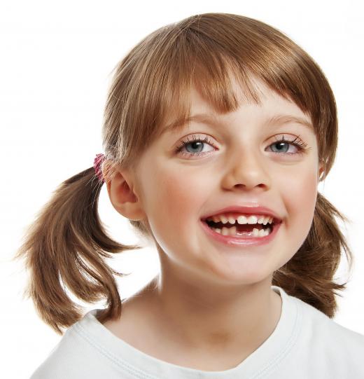 Children may have sealants placed on their teeth to help avoid cavities.