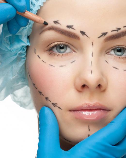 A laser face lift destroys the top layer of skin to encourage new skin cell growth.