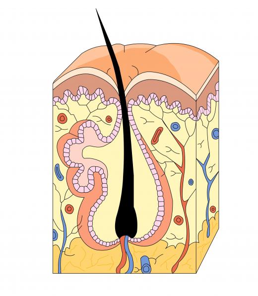 An autoimmune condition where the body attacks hair follicles can result in hair loss.