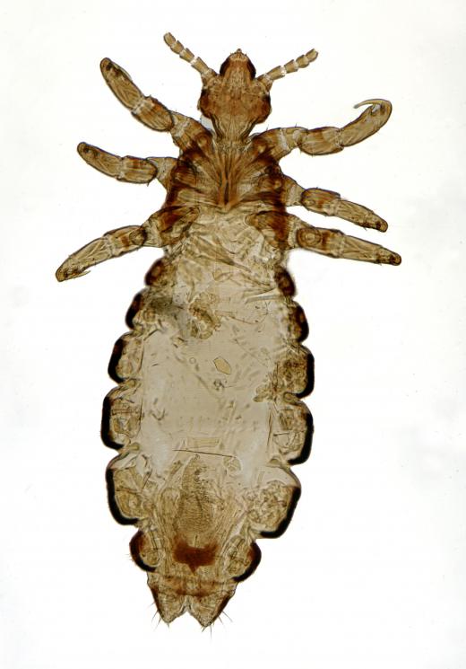 Head lice can cause itching.