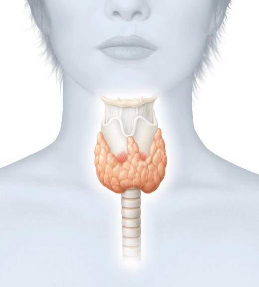 Desiccated thyroid may be used to treat other thyroid conditions , such as goiter.