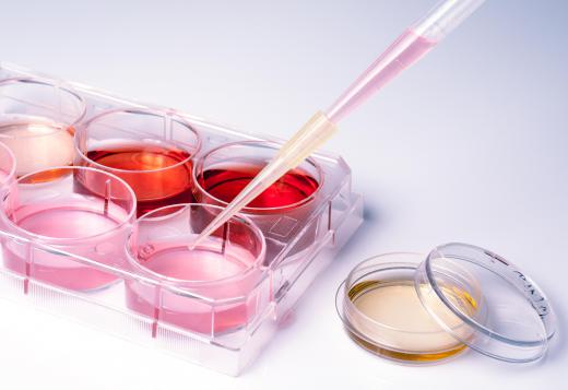 ELISA kits may require a blood sample.