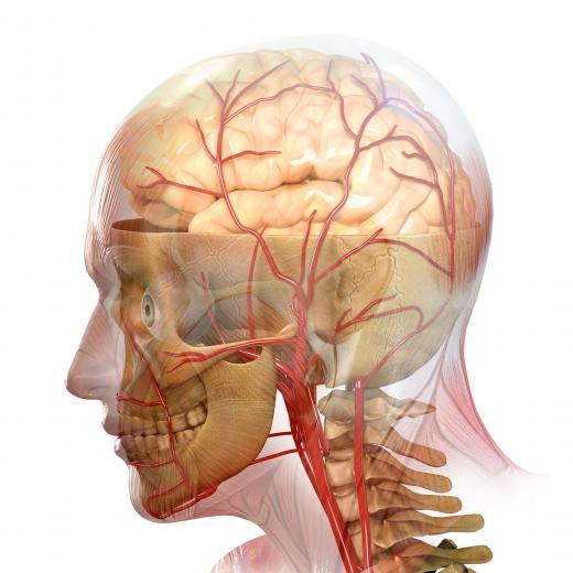 The human brain, including blood vessels that can hemorrhage.