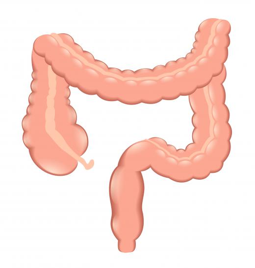 A human colon.