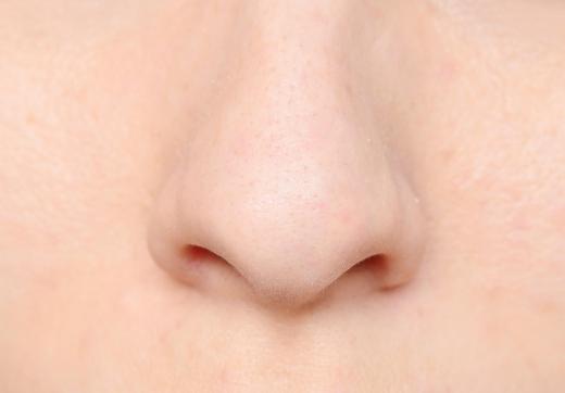 A common cold may cause yellow phlegm coming from the nose.