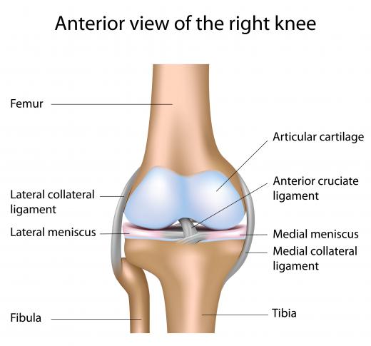 A diagram of the knee, showing the medial collateral ligament (MCL).