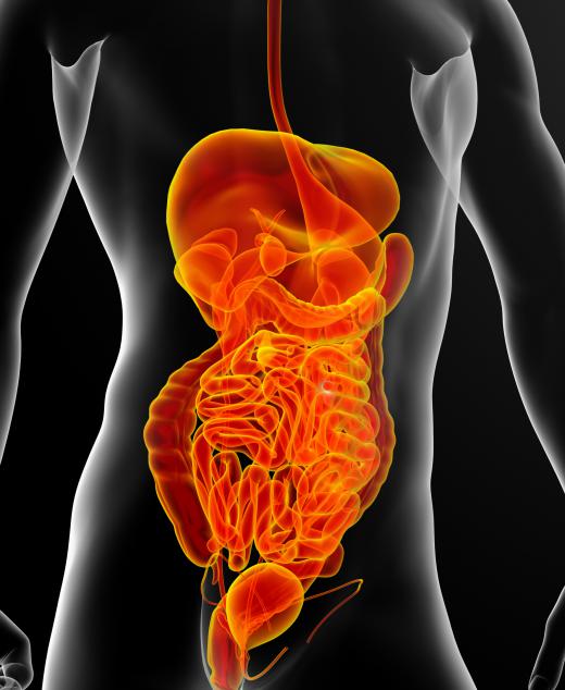 Gastrointestinal bleeding is a condition marked by the presence of any blood loss anywhere along the GI tract.