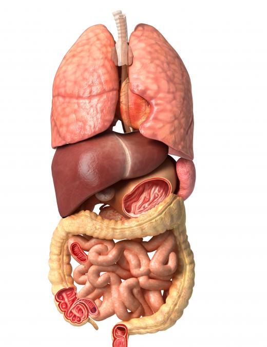 A porcelain gallbladder occurs when the gallbladder wall has calcified to a hard texture.