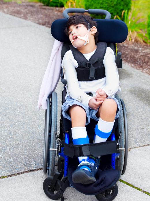 The severity of someone's cerebral palsy can affect his life expectancy.