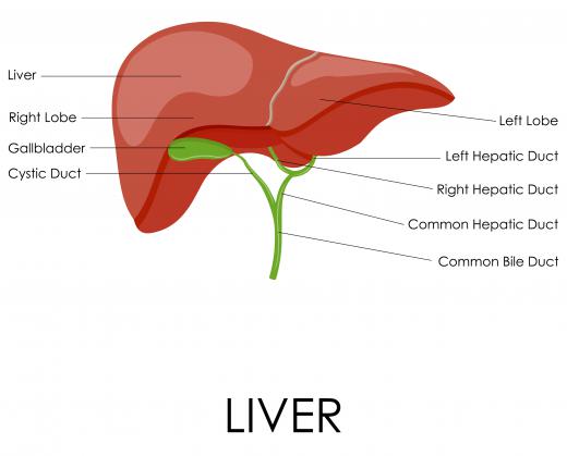 Excess amounts of inactive iron in the liver can lead to cirrhosis.