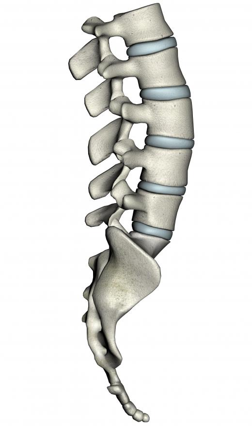 Degenerative discs in the spine can cause tingling, numbness, or pain.