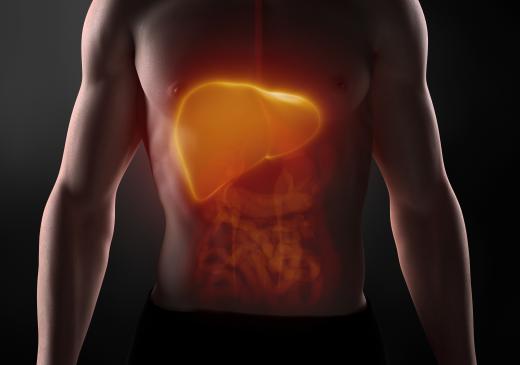 Chronic inflammation of the liver caused by immune system malfunction is referred to as autoimmune hepatitis.