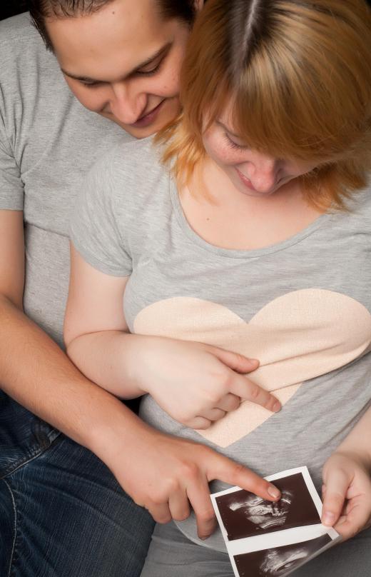 Viewing fetal movements on an ultrasound can be an exciting moment for couples.