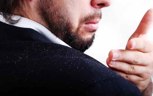 Dandruff conditioner attempts to prevent flakes.