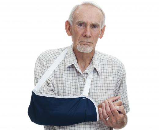 A sling may be required to treat a fractured humerus.