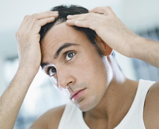 Male hair replacement can make existing hair thicker, or completely cover bald spots.