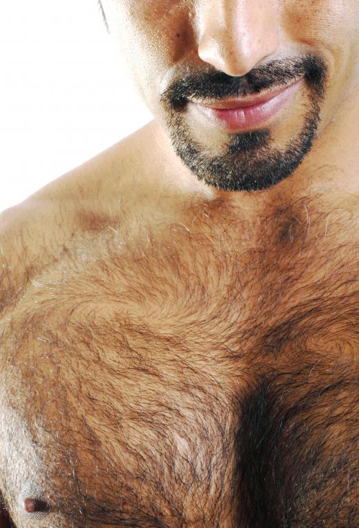 Men may choose electrolysis to permanently remove hair in unsightly places.