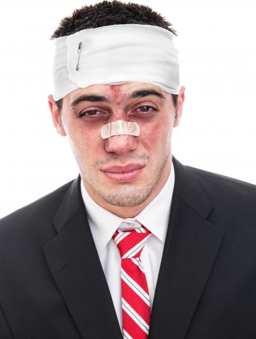 Injuries to the nose can cause profuse bleeding.