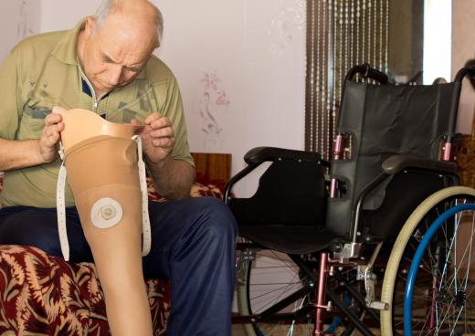 Patients with prosthetics that do not fit correctly may experience phantom pain.