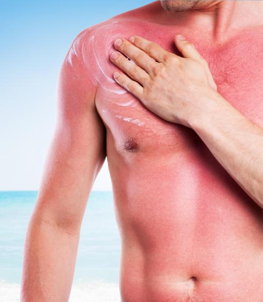 People with dominant pitta energy are said to be vulnerable to sunburn and heat-related sicknesses.