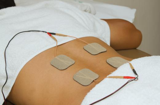 Pain relief techniques in physiotherapy for cervical spondylosis often include electrical stimulation of the back and neck.