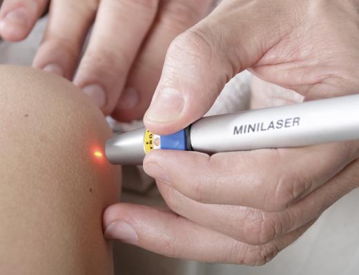 Laser acupuncture may help control symptoms of inflammation.