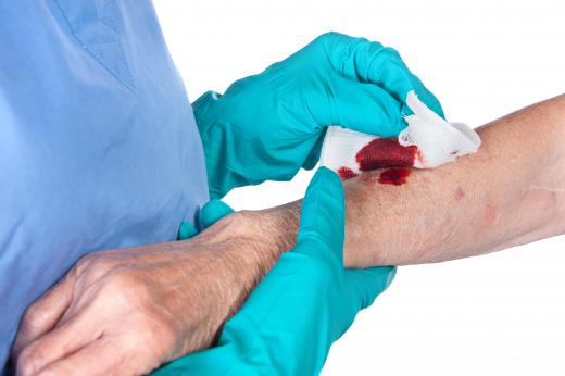 A certified wound specialist may help teach patients about caring for their wounds at home.