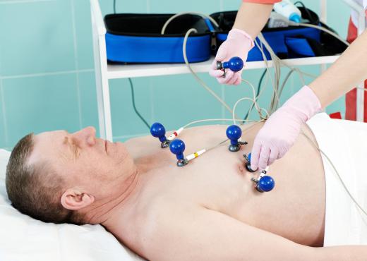 An electrocardiogram can be used to determine the type of arrhythmia a person is experiencing.