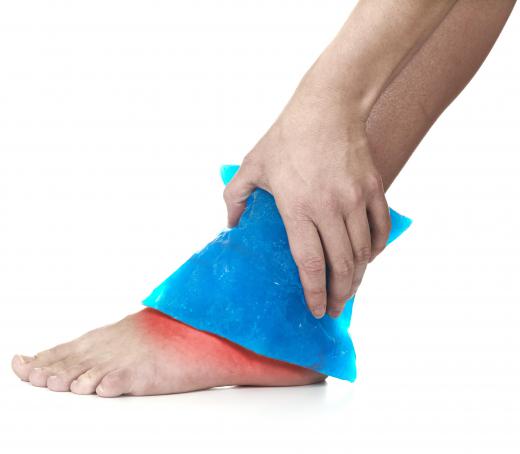 Ice is often used to treat the swelling caused by a sprained ankle.