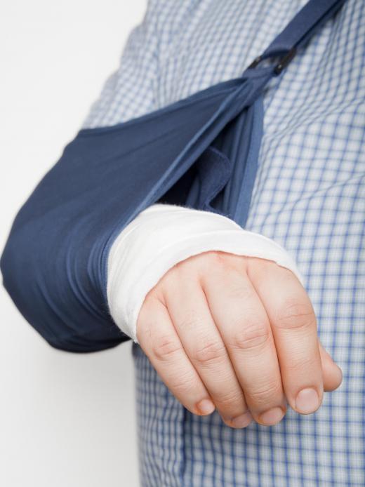 A broken arm may cause radial nerve damage.