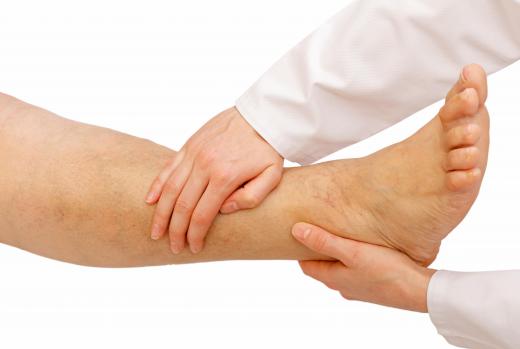 The knees and ankles are common locations of swelling.