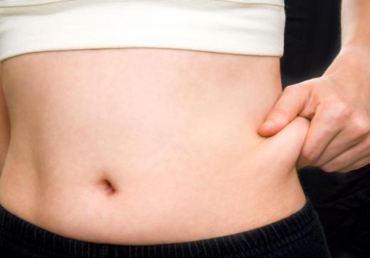 Smart liposuction can be used to reduce fat in the belly.