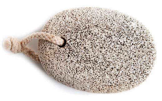 A pumice stone, which can be used to treat calluses caused by Morton's toe.