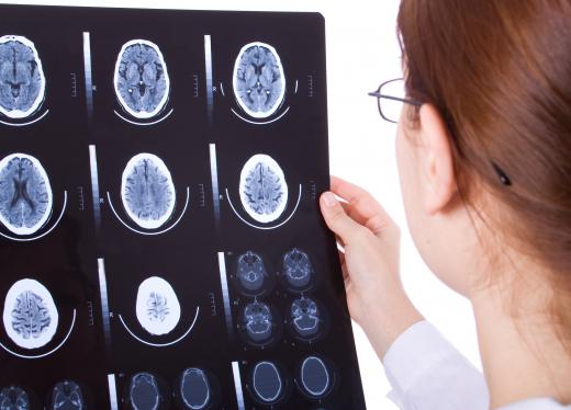 A traumatic brain injury may be permanent or temporary.