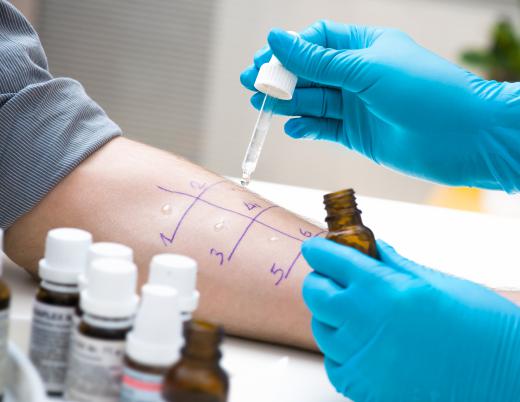 A skin allergy test can be used to determine a medical diagnosis for certain allergies by introducing small samples of the allergens to the skin.