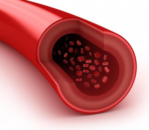 Low levels of cholesterol indicate that blood can flow freely throughout the body.