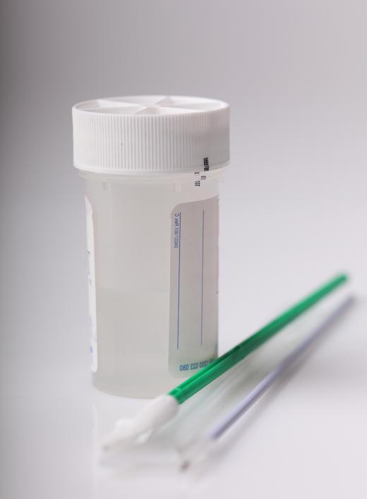 A vaginal or cervical swab can be administered to test for certain sexually transmitted diseases in women at an STD clinic.